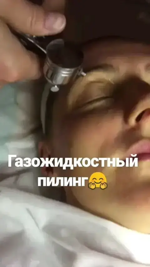 Газожидкостный пилинг